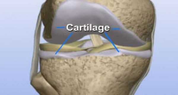 Naturally Restore Knee Cartilages - Make Your Life Healthier