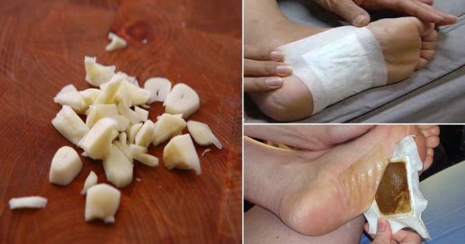 Get Rid of Dangerous Toxins Overnight With These Homemade Detox Foot